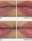 Lip Plump 15 Minutes