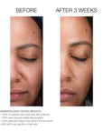 Travel Size Lactic Acid Retexturing Micro-Peel